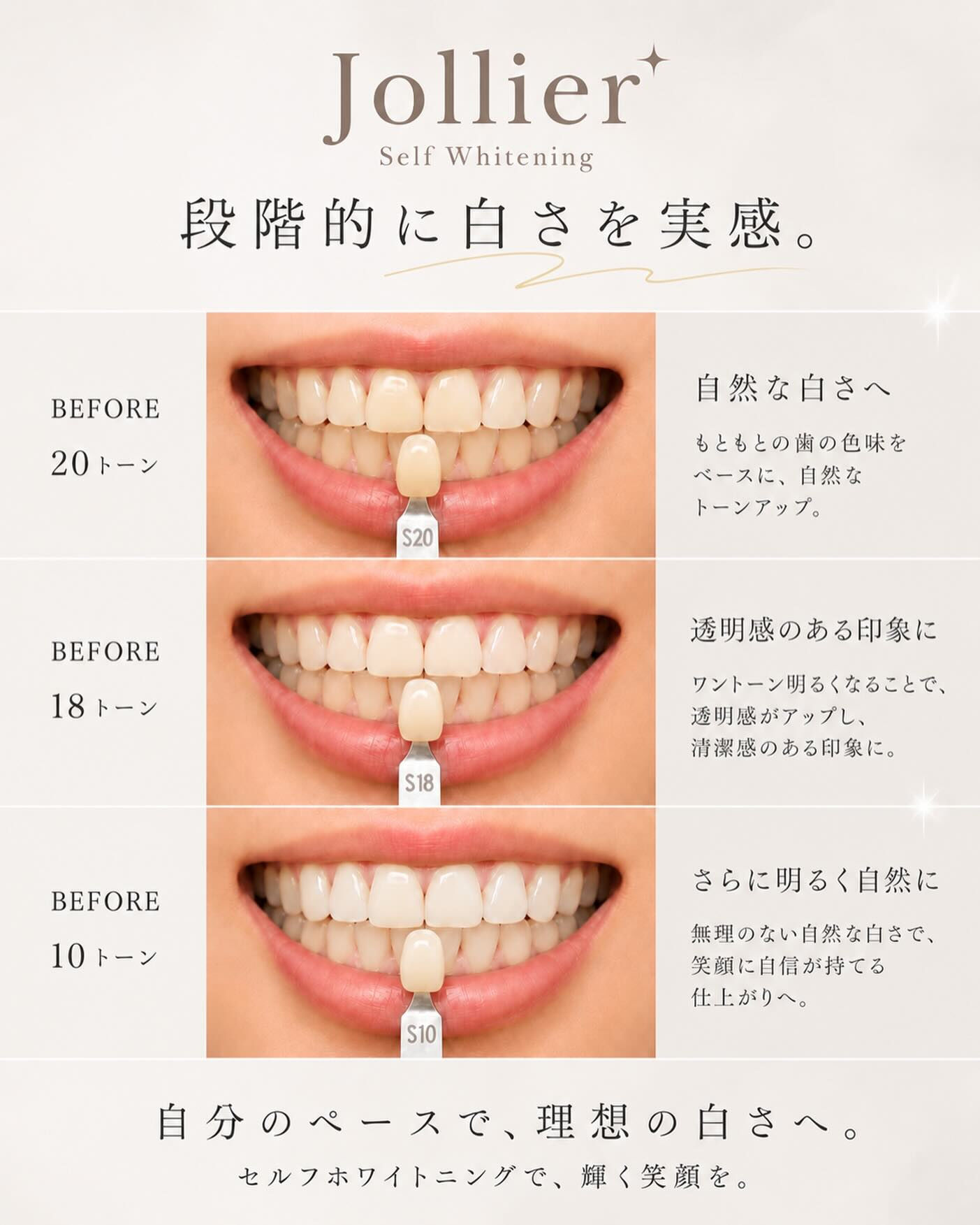 笑顔をもっと輝かせませんか？✨